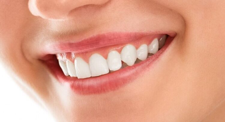 Makanan untuk gigi putih