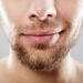 Jangan Dianggap Sepele, Ini Cara Memperbaiki Bibir Kering yang Mengelupas!