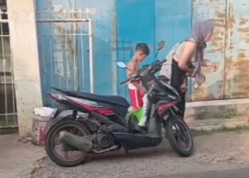 Tragis! Ibu dan Anak di Sukabumi Jadi Korban Penyiraman Air Keras Saat Sedang Naik Motor, Begini Kronologi dan Kondisi Korban
