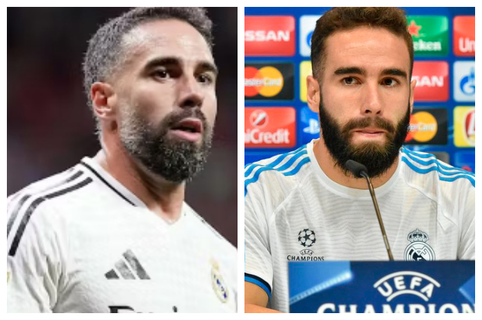 Real Madrid Tanpa Dani Carvajal untuk Sepuluh Laga, Alexander-Arnold Ambil Alih Bek Kanan