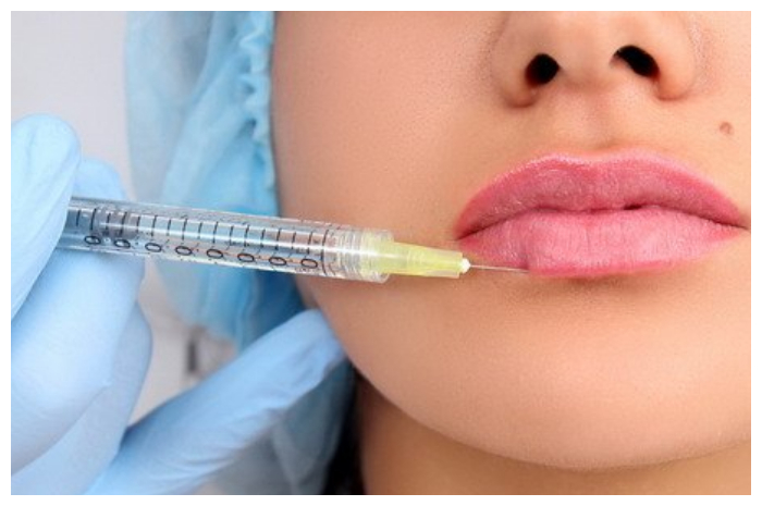 Ingin Wajah Lebih Muda? Kenali Jenis dan Risiko Suntik Filler