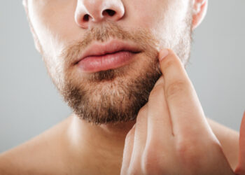 Gampang, Ini Cara Mengatasi Bibir Kering Saat Puasa, Gimana Caranya?