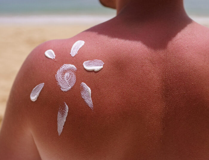 Sering Dianggap Sepele, Ini Manfaat Menggunakan Sunscreen untuk Kulit