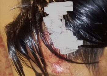 Dibacok OTK Diduga Geng Motor, Seorang Pedagang Cuanki di Cinunuk Luka Berat