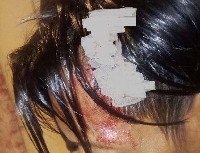 Dibacok OTK Diduga Geng Motor, Seorang Pedagang Cuanki di Cinunuk Luka Berat