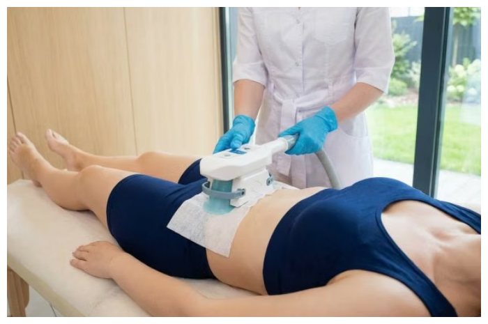 Cryolipolysis, Solusi Praktis Atasi Lemak Membandel