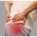 Pubalgia atau Sports Hernia Bukan Hernia Biasa, Ini Penjelasan Medisnya