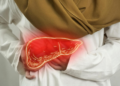 Kenali Hepatitis Sejak Dini untuk Mencegah Kerusakan Hati