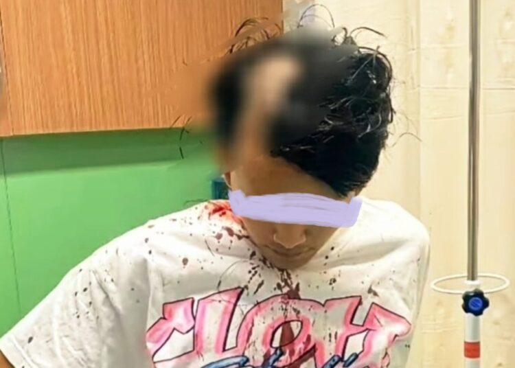 Sadis, 2 Begal Beraksi di Antapani, RM Seorang Pemuda Dibacok, Motor dan Uang Tunai Rp 1,5 Juta Raib 1 Sadis, 2 Begal Beraksi di Antapani, RM Seorang Pemuda Dibacok, Motor dan Uang Tunai Rp 1,5 Juta Raib