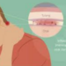 Jangan Abaikan! Kebiasaan Sehari-hari Ini Bisa Picu Meningitis 9 Jangan Abaikan! Kebiasaan Sehari-hari Ini Bisa Picu Meningitis