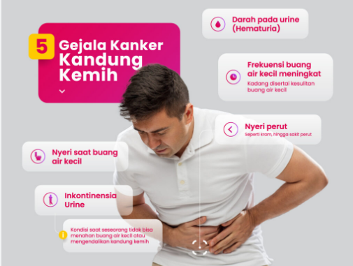 Studi Terbaru Temukan Cara Mengobati Kanker Kandung Kemih Tanpa Angkat Organ 1 Studi Terbaru Temukan Cara Mengobati Kanker Kandung Kemih Tanpa Angkat Organ