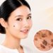 Muncul Bercak atau Benjolan Cokelat di Kulit? Waspadai Keratosis Seboroik 9 Muncul Bercak atau Benjolan Cokelat di Kulit? Waspadai Keratosis Seboroik