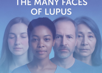 Mengenal Lupus, Penyakit Autoimun yang Berjuluk "Penyakit Seribu Wajah" 3 Mengenal Lupus, Penyakit Autoimun yang Berjuluk “Penyakit Seribu Wajah”