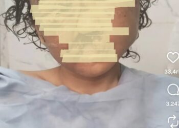 Tiga Tahun Jadi Korban Penyekapan dan Penganiayaan Berat, KemenHAM Turun Tangan